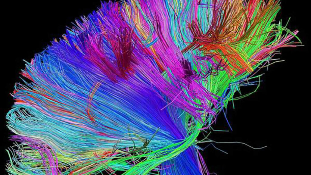 Colourful diffusion MRI of brain fibre tracts.