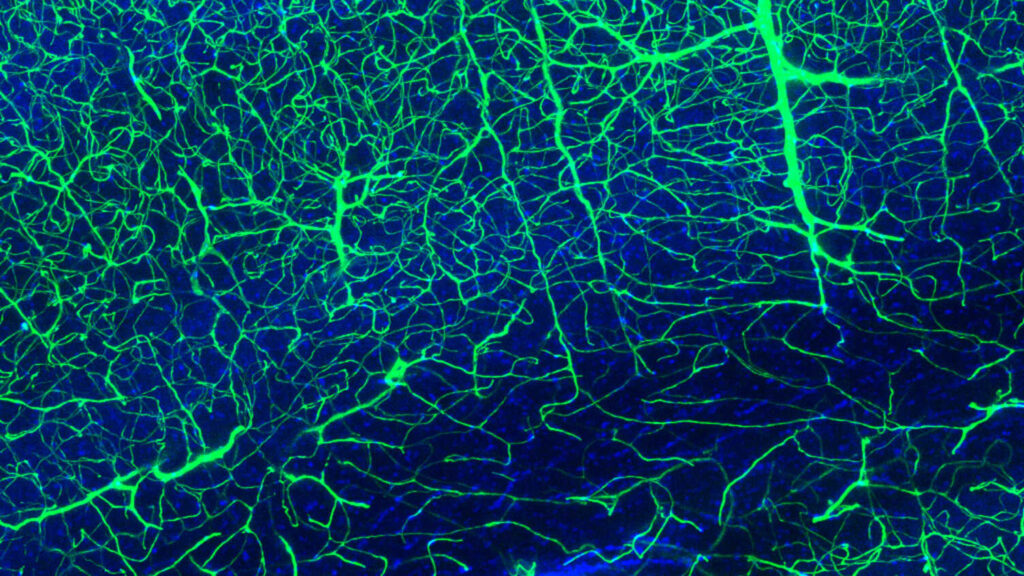 Microscopic image of branching nerve fibres.